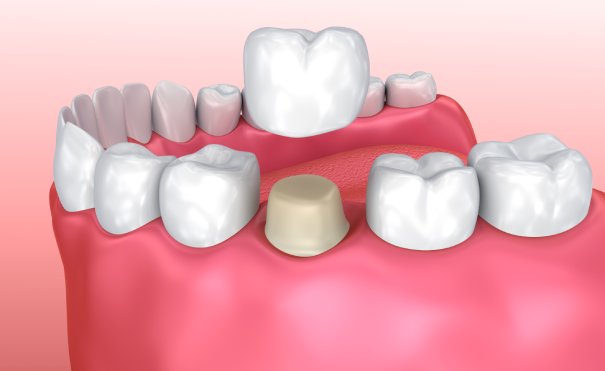 man smiling in dentists chair