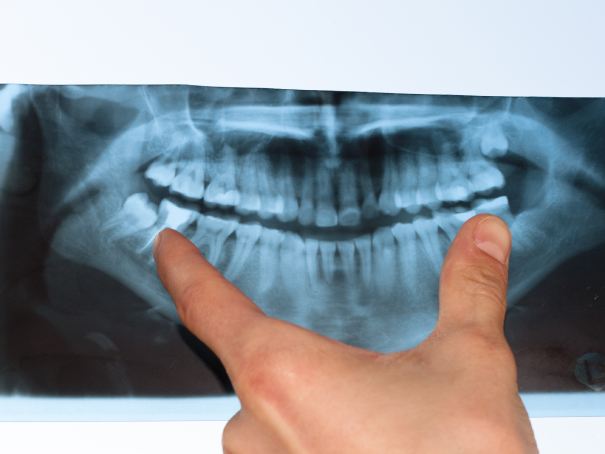 man smiling in dentists chair