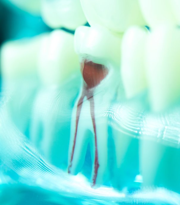 man smiling in dentists chair