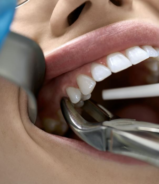 man smiling in dentists chair